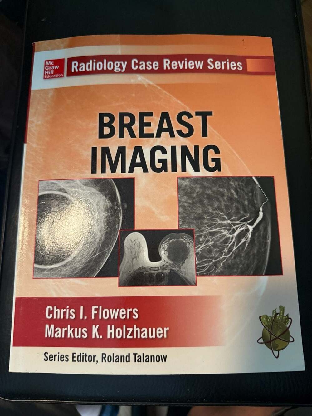 Radiology Case Review Series: Breast Imaging by Chris I. Flowers and Markus K.
